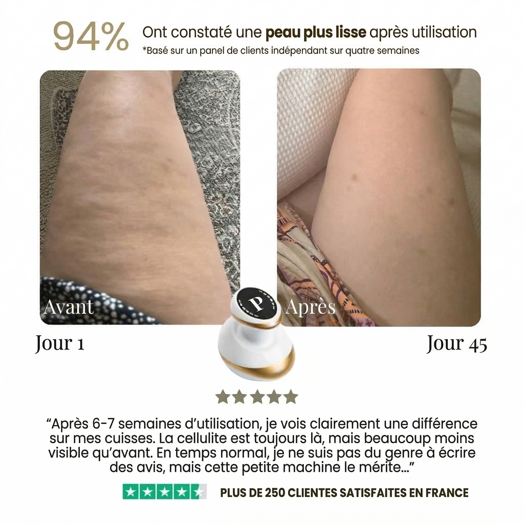 LiftSoir™ - Appareil peau lisse anti-cellulite