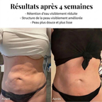 LiftSoir™ - Appareil peau lisse anti-cellulite